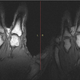 Illustration for article titled MRI video reveals what it actually looks like when you crack your joints